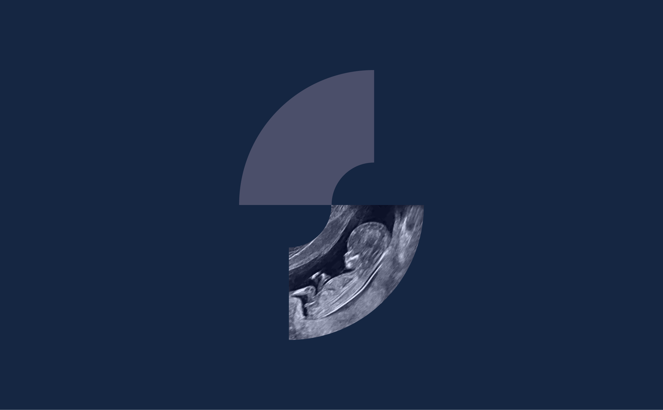 echography medical S letter logo